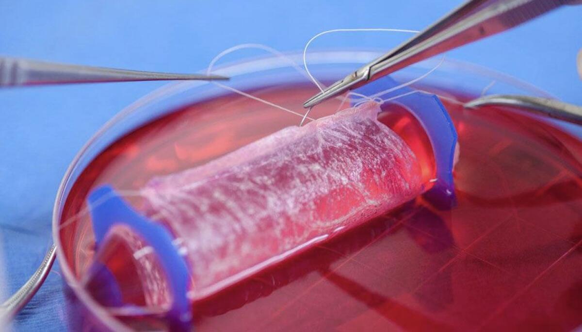 Vagina bionica: nuovi traguardi nell'ingegneria dei tessuti - credits: goodnews.ws