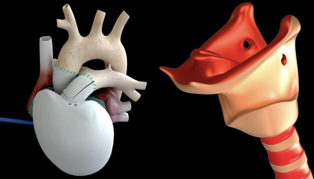 Organi in stampa 3D per salvare vite umane - 