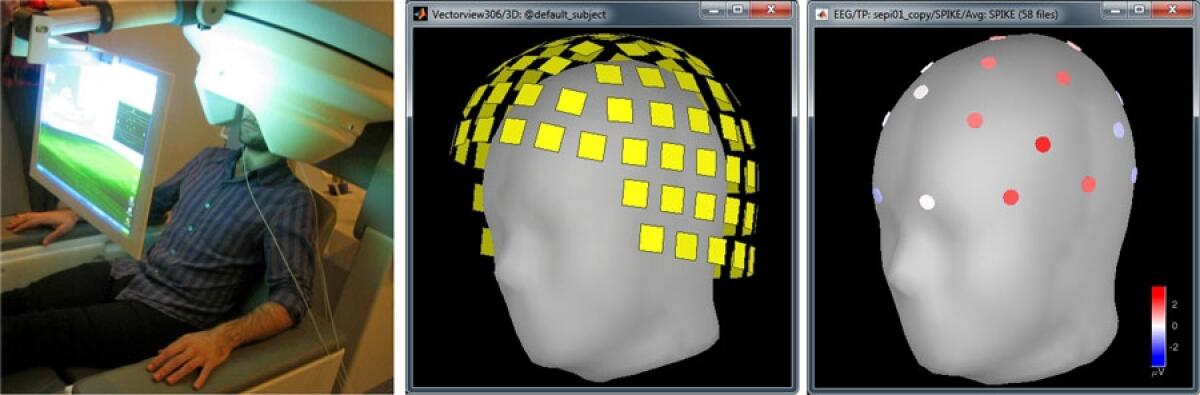 Brainstorm: un'applicazione MATLAB open-source per l'analisi di dati MEG/EEG - Brainstorm lets neuroscientists with no experience in programming to see and elaborate big volumes of MEG and EEG data. Credits: www.mathworks.com