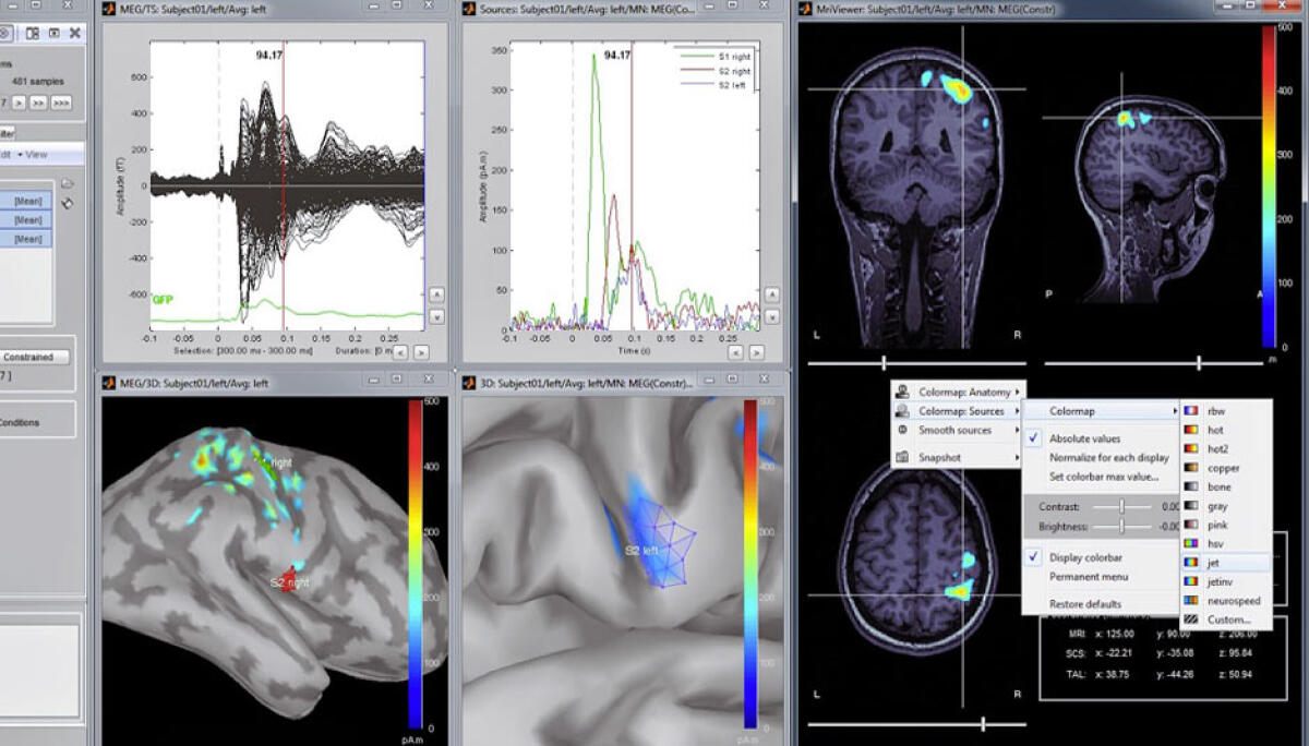 Brainstorm: MATLAB open-source application for MEG/EEG data analysis - ©brainstorm