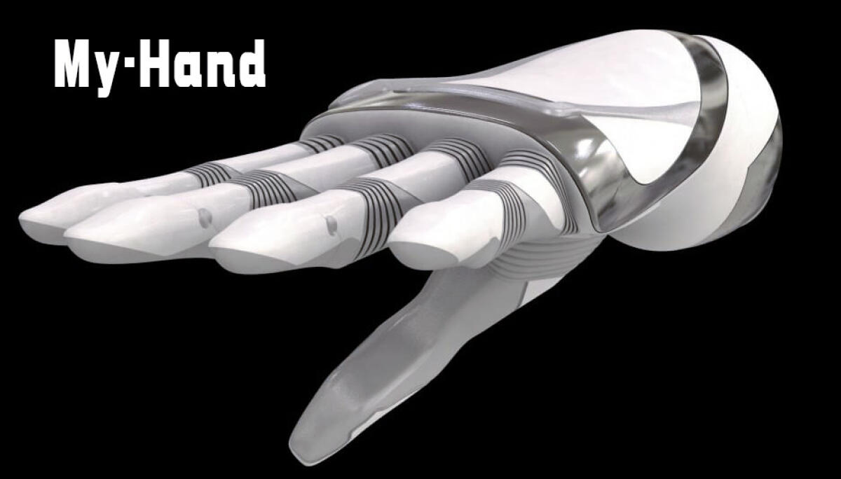 My-Hand: "It's a prosthesis to show off not to hide" - 