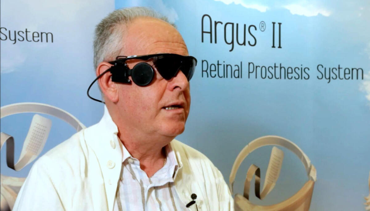 Occhio Bionico Argus II : impianto protesico epiretinale - secondsight.com
