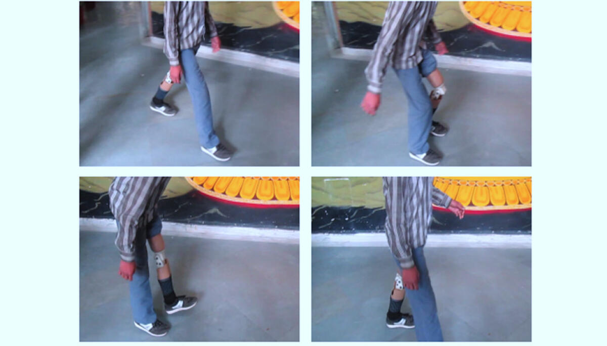 ATKnee: MIT, ginocchio protesico low cost - Source: web.mit.edu