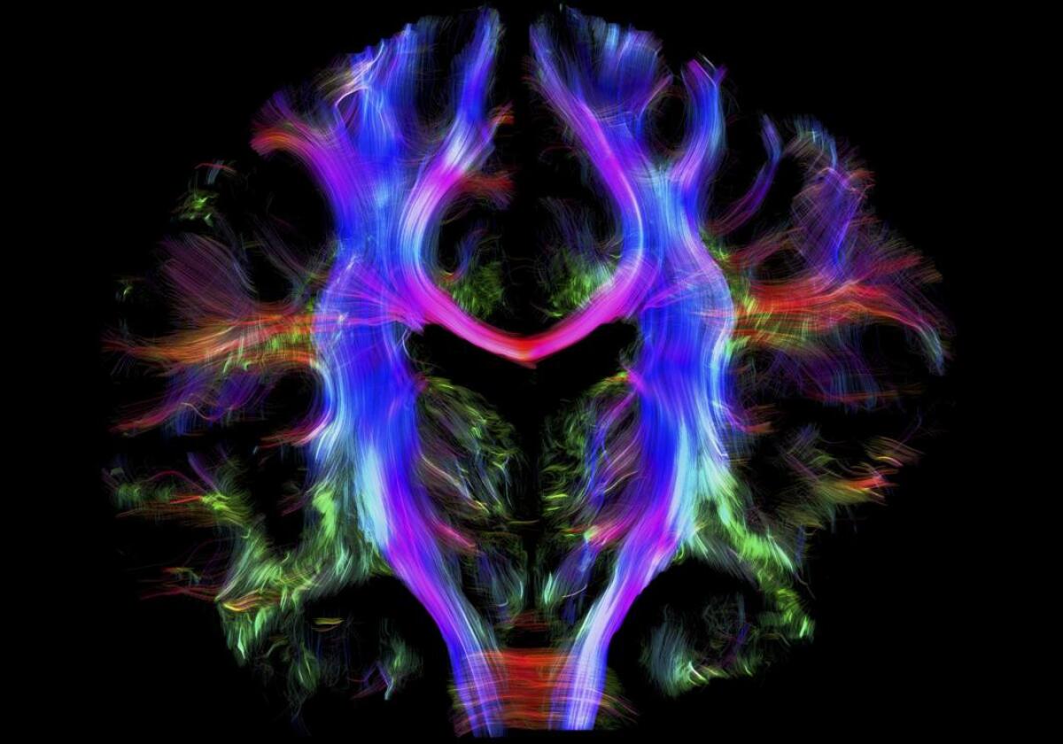 Wellcome Image Awards 2016: le foto vincitrici - Fibre nervose nel cervello di un giovane adulto sano: diverse zone del cervello comunicano tra di loro attraverso queste fibre nervose. La larghezza di questo cervello è di 16,5 cm. La foto è di Alfred Anwander del Max Planck Institute for Human Cogn