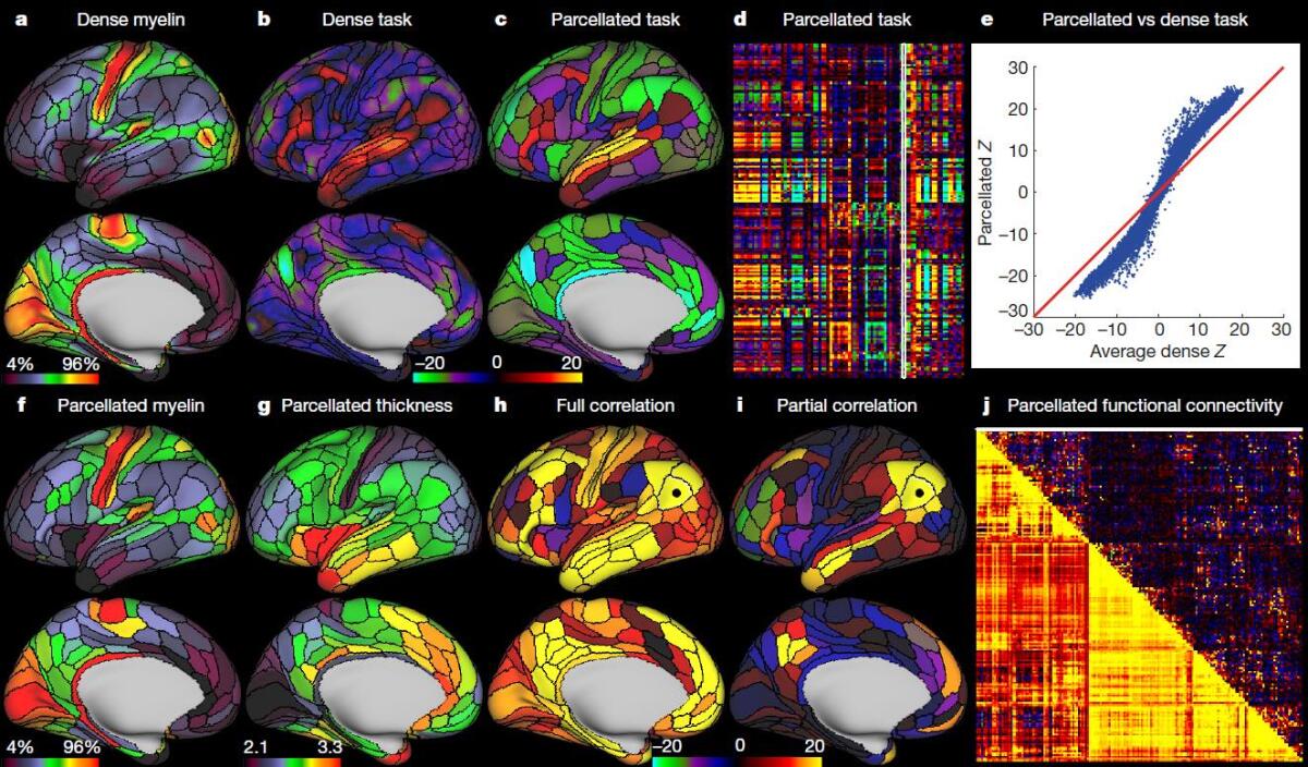 Il cervello umano come non l'avete mai visto - 