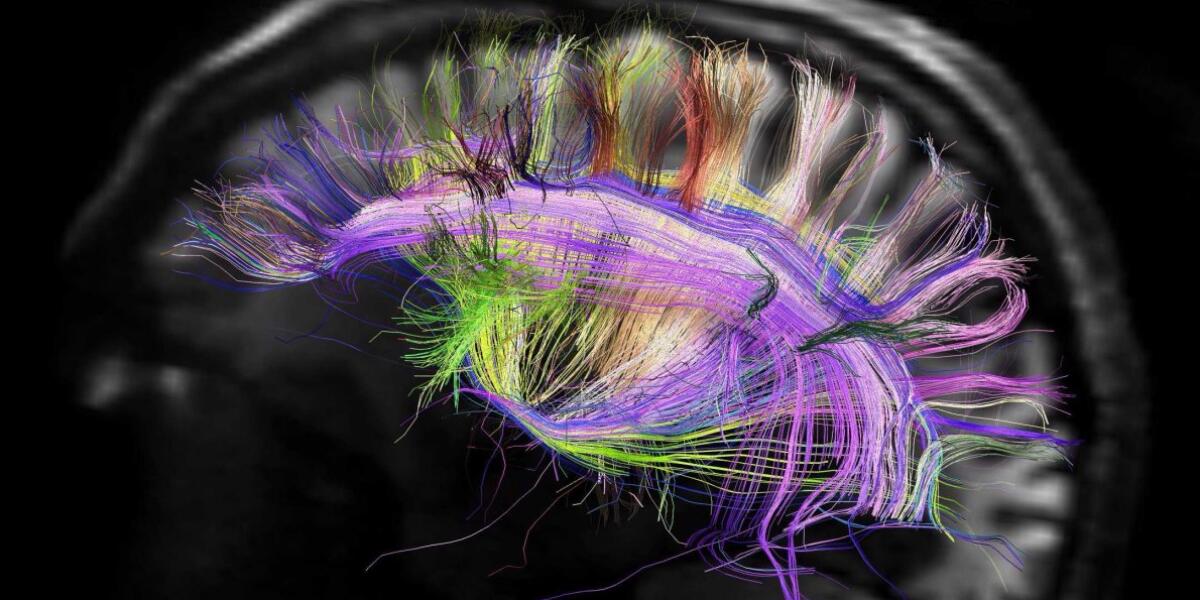 Ultrasuoni terapeutici per "risvegliare" un cervello in coma - Ultrasuoni utilizzati per la riattivazione cerebrale di un cervello in coma 
futurism.com