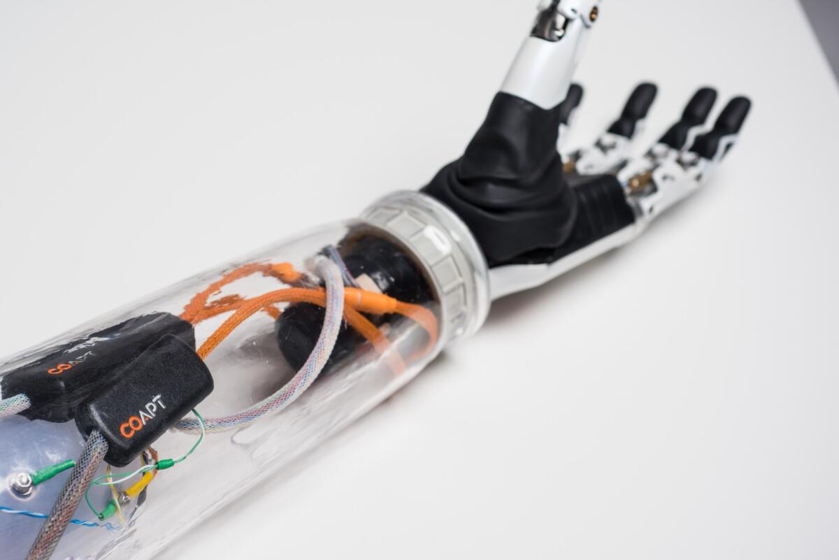 Bionic Arms get the thought-control: now it's possible! - Coapt's device on a prothesis
vnews.agency