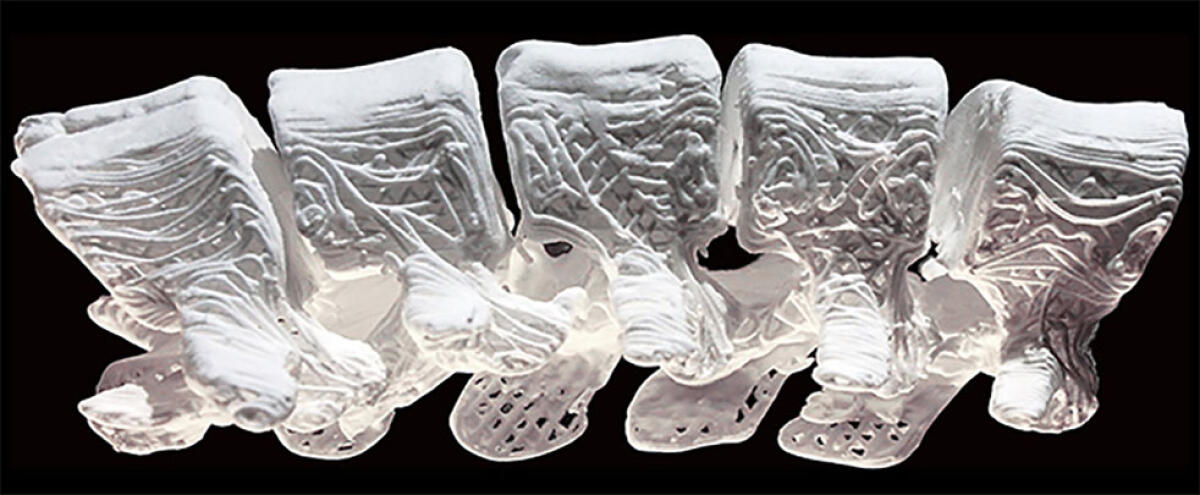 Ossa iperelastiche: il nuovo biomateriale realizzato con la stampante 3D - Possibile applicazione del "Hb" nella realizzazione di una spina dorsale
ieee.org
