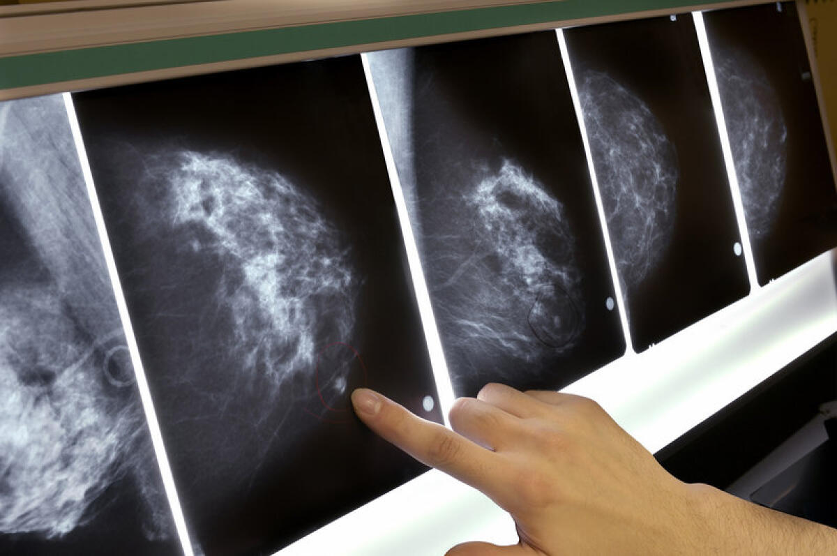 Intelligenza Artificiale legge le mammografie con il 99% di accuratezza - 