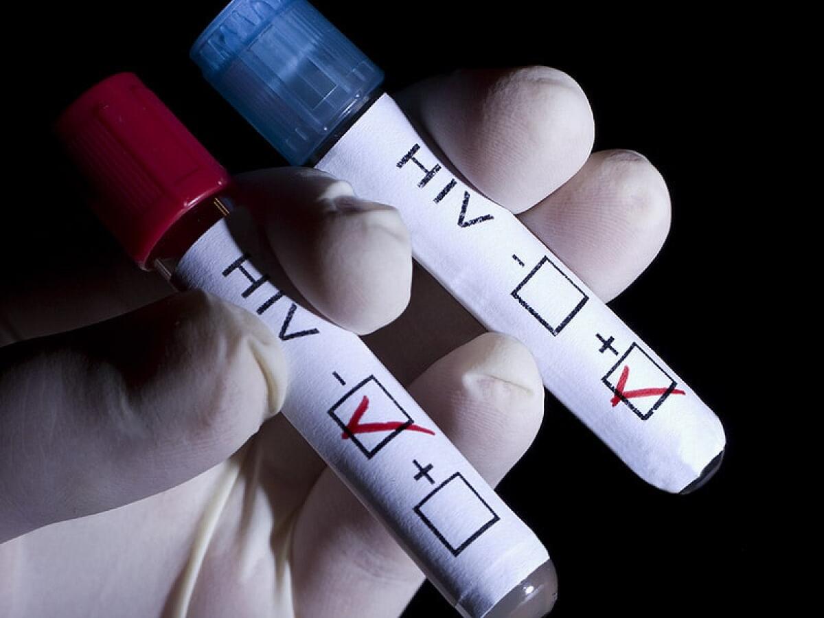 Arriva il test 'fai da te' per scoprire se hai l'HIV - Test HIV, credits: ravennaedintorni.it