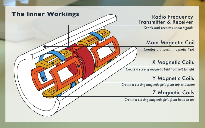 Componenti dello scanner MRI http://www.howtolearn.com