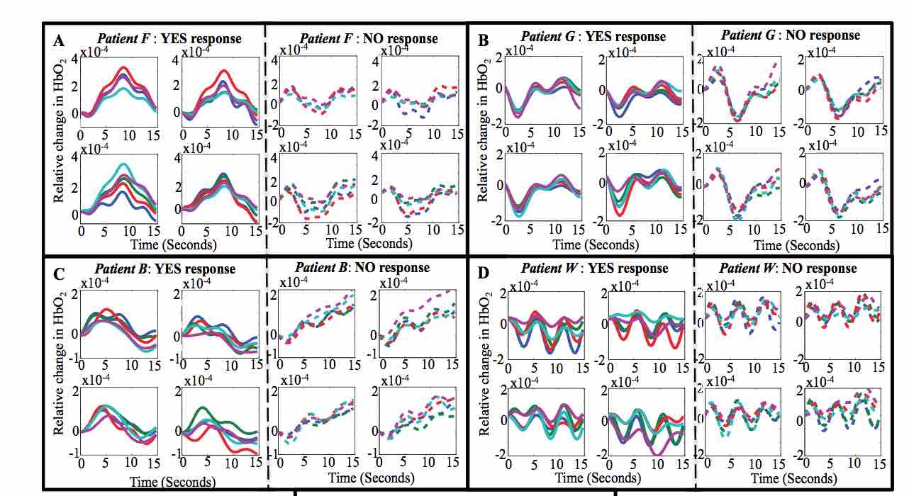 Rappresentazione delle variazioni emo-dinamiche dei 4 pazienti in relazione alle risposte "si" o "no" http://journals.plos.org