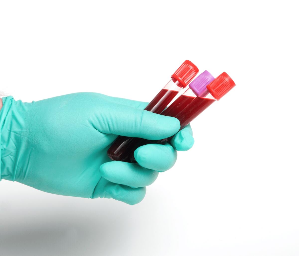 Sangue artificiale con le cellule staminali - Image Credits: nuovabrianza.it