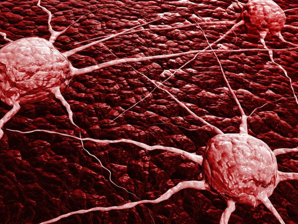 Stampa 3D: nuovi modelli per studiare il cancro - Cellula tumorale
Credit: Biomedical | Shutterstock