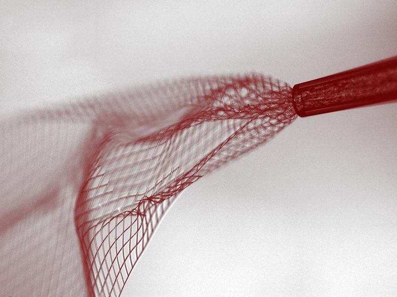 Neural Lace i.kinja-img.com