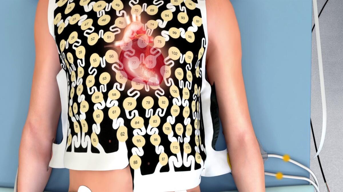Medtronic's CardioInsightTM Mapping Vest: una “maglia” per il cuore - The CardioInsight™ Noninvasive 3D Mapping System
https://i.ytimg.com