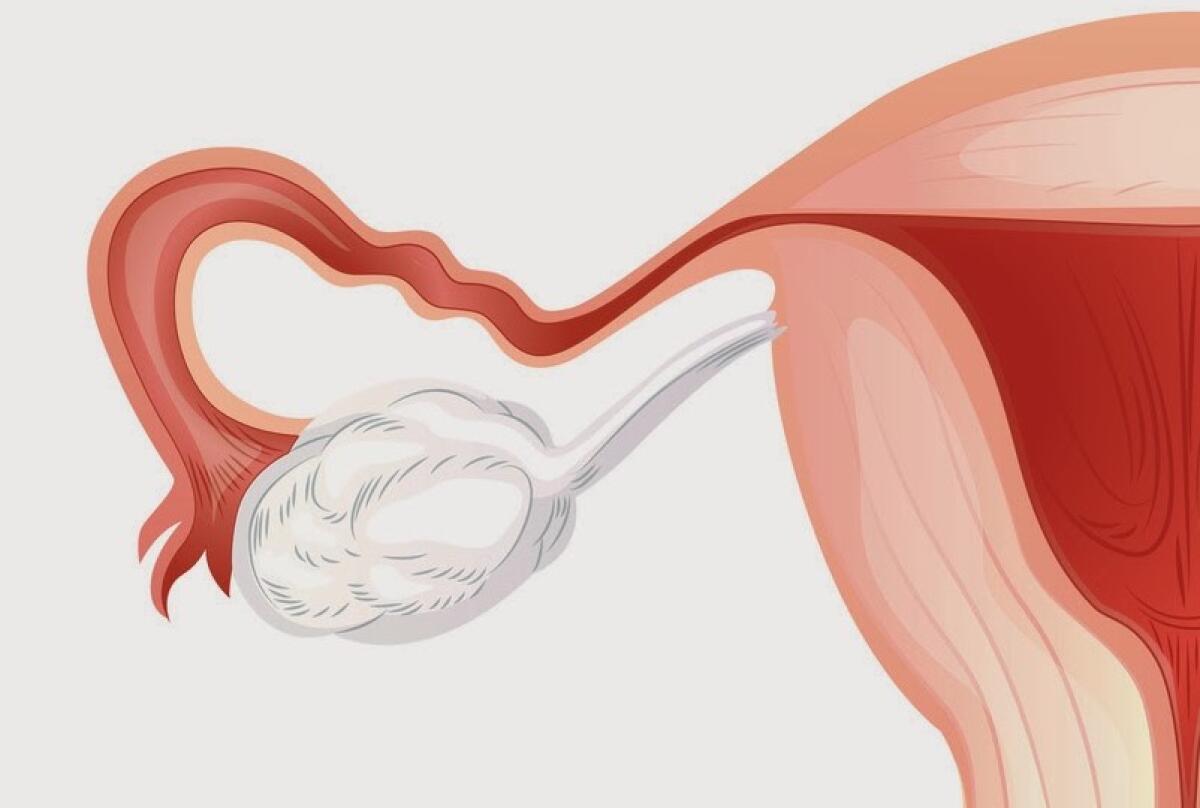 Ovaia stampata in 3D: prole sana nata da topi sterili - Ovaia 3D ha reso possibile gravidanza in topi sterili
http://www.attiliodispiezio.com/