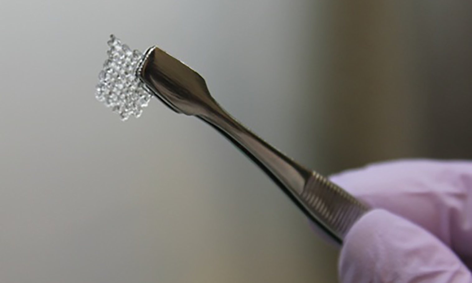 Ovaia 3D realizzata con una speciale “gelatina”.http://www.northwestern.edu/