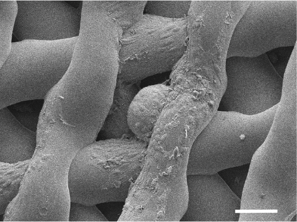 Immagine microscopica di un uovo immaturo di topo, circondato da cellule di sostegno, dopo che è stato ospitato in una bioprotesi ovarica per sei giorni.http://news.feinberg.northwestern.edu