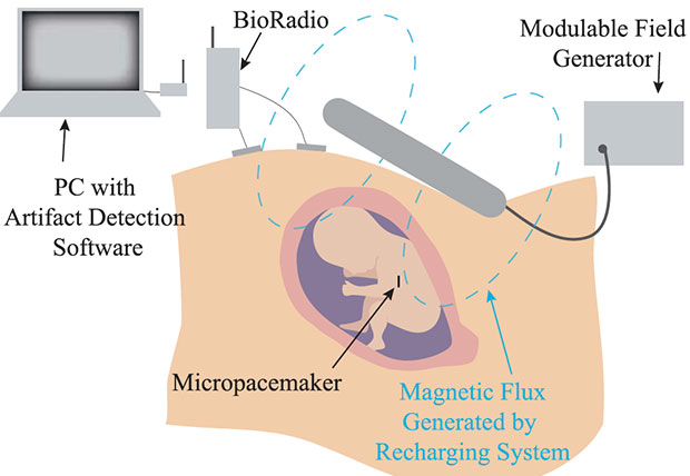 Sistema di ricarica wireless per il pacemaker fetale http://spectrum.ieee.org/