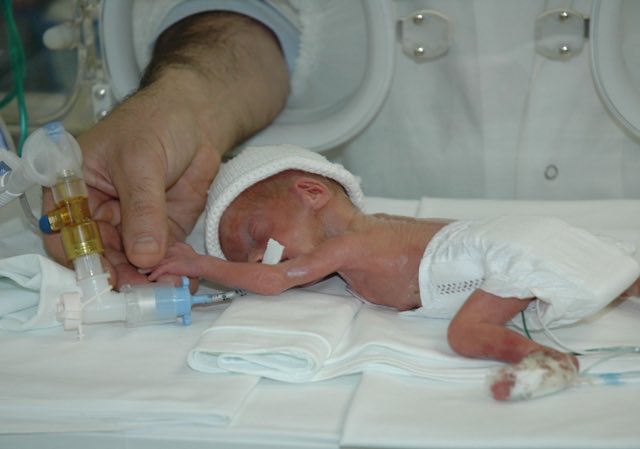 Neonato pretermine destinato all'incubatrice http://www.mammeoggi.it