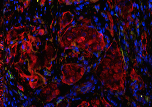 Microscopia a fluorescenza delle Isole di Langerahans nell’omento trapiantate all'interno dello scaffold biologico. In rosso è evidenziata l’insulina https://www.diabetesresearch.org