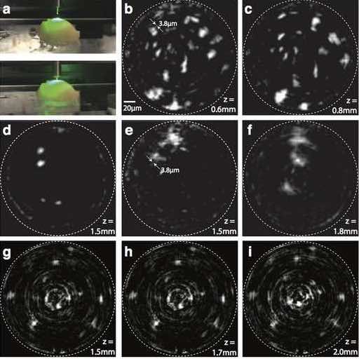Cellule della microglia del cervello di un roditore osservate con la CCM: (a) fotografia del campione con la cannula in prossimità, (b-f) e (g-i) immagini ottenute a diverse profondità in due differenti campioni. https://www.nature.com/articles/srep44791
