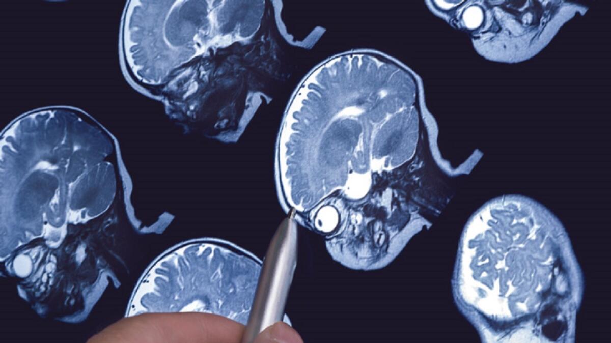 Neuroimaging e Machine Learning per predire l’autismo nei bambini - neuroimaging e autismo
http://www.illustratedcuriosity.com
