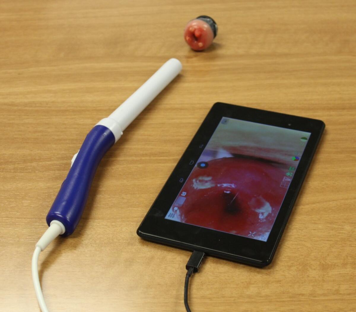 Pocket Colposcope, screening del cancro cervicale - Il tablet mostra l'immagine del modello plastico della cervice uterina.
Credits: globalhealth.duke.edu