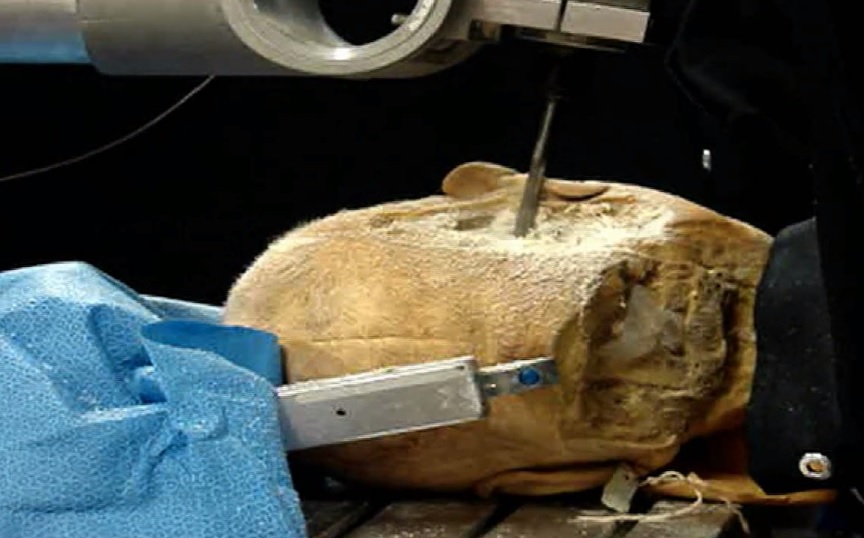 Trapano ripreso ad eseguire un'apertura translabirintica su un cranio di cadavere https://healthcare.utah.edu