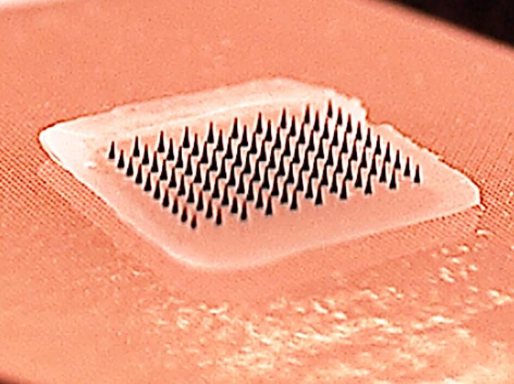 In dettaglio, i microaghi che andranno a dissolversi una volta a contatto con la pelle, rilasciando il vaccino nell'organismo http://www.news.gatech.edu