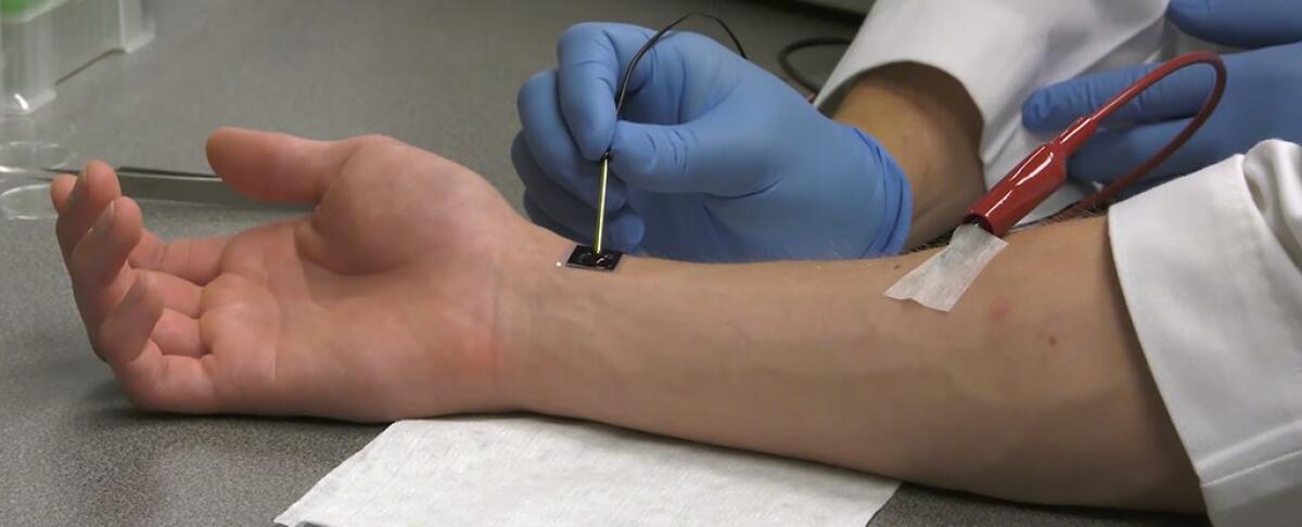 Sembra uscito da un film il nanochip che cura i tessuti con un singolo tocco - Il nanochip che cura i tessuti con un singolo tocco
https://wexnermedical.osu.edu