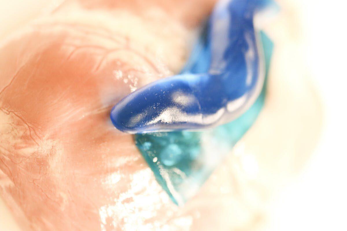 Ecco l'adesivo super resistente che cura le ferite ispirato... ad una lumaca! - Adesivo super resistente per curare le ferite ispirato... ad una lumaca!
https://scienceblog.com