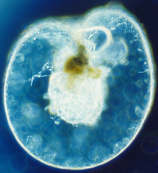 Noctiluca scintillans, credits: wikimedia.org