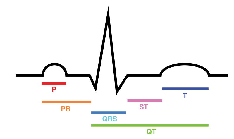 Tracciato ECG. Fonte: Wikimedia