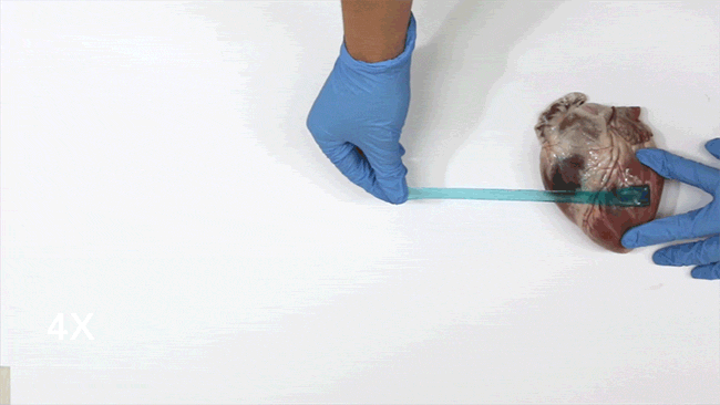 Applicato su un cuore suino, questo materiale mostra tutta la sua estensibilità ed aderenza anche su tessuti umidi.http://www.pbs.org