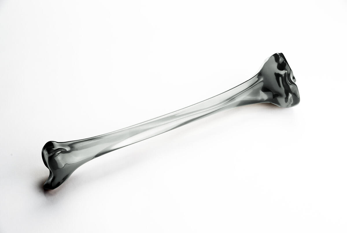 Effettuato in Australia il primo impianto al mondo di tibia stampata in 3D - Modello 3D della tibia umana
https://broadviewproduct.com