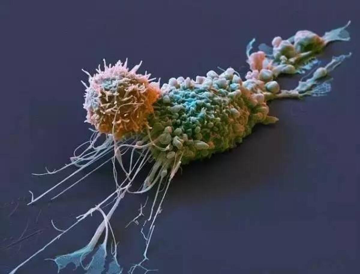 Leucemia sconfitta con una puntura da 475.000 dollari - virus, credits: mmbiz.qpic.cn