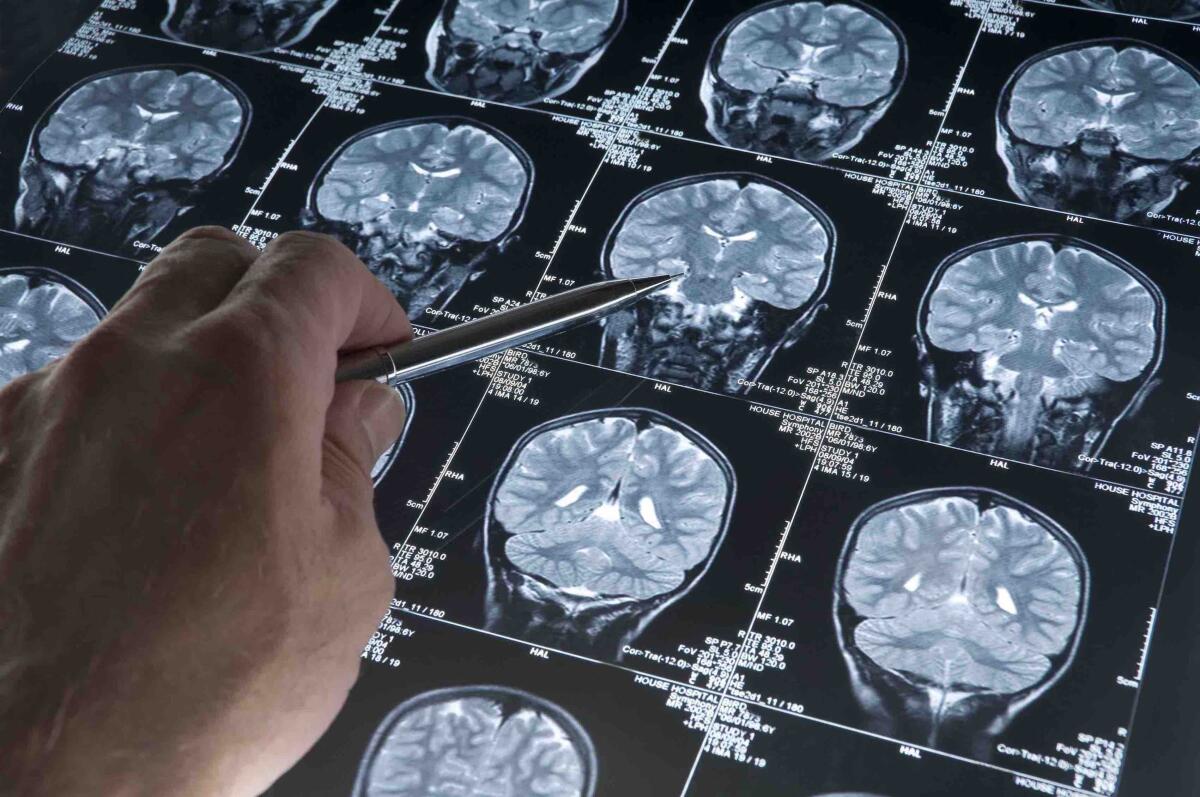 Intelligenza artificiale e diagnosi precoce dell'Alzheimer - MRI scans
https://fthmb.tqn.com