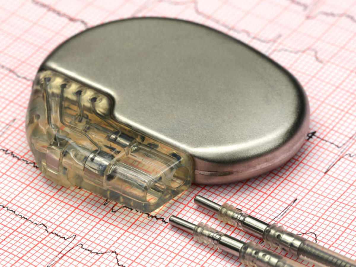 Bologna: impiantato il primo pacemaker senza fili e sottopelle - Pacemaker 
http://www.healthline.com