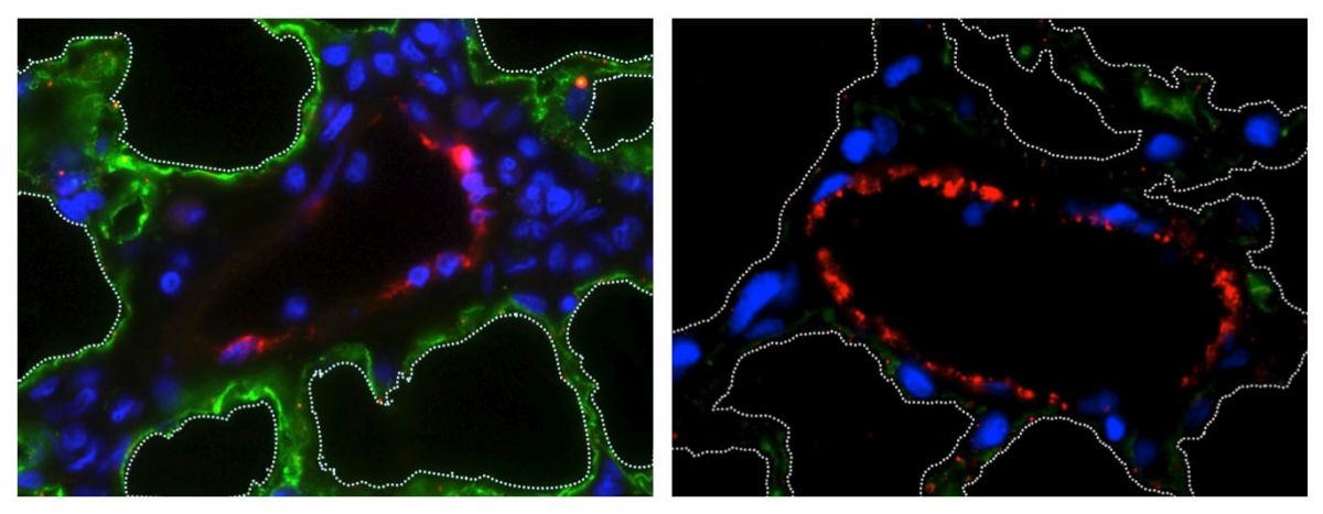 A sinistra: tessuto polmonare intatto con cellule epiteliali (in verde) e cellule vascolari (in rosso). A destra: le cellule epiteliali sono state rimosse. La linea tratteggiata rappresenta gli alveoli. Credit: N. Valerio Dorrello and Gordana Vunjak-Novak