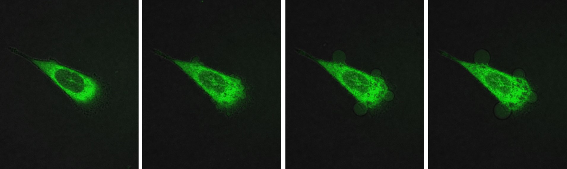 Questa sequenza di immagini, acquisite nell'arco di 10 minuti, mostra la cellula tumorale prostatica attaccata dalla molecola motorizzata. La cellula, contrassegnata da una proteina fluorescente verde, viene resa permeabile dalla perforazione della membra
