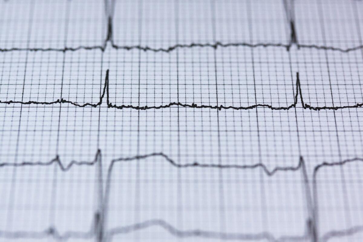Sicurezza informatica: dopo l'impronta digitale arriva la scansione cardiaca - Sicurezza informatica: dopo l'impronta digitale arriva la scansione cardiaca