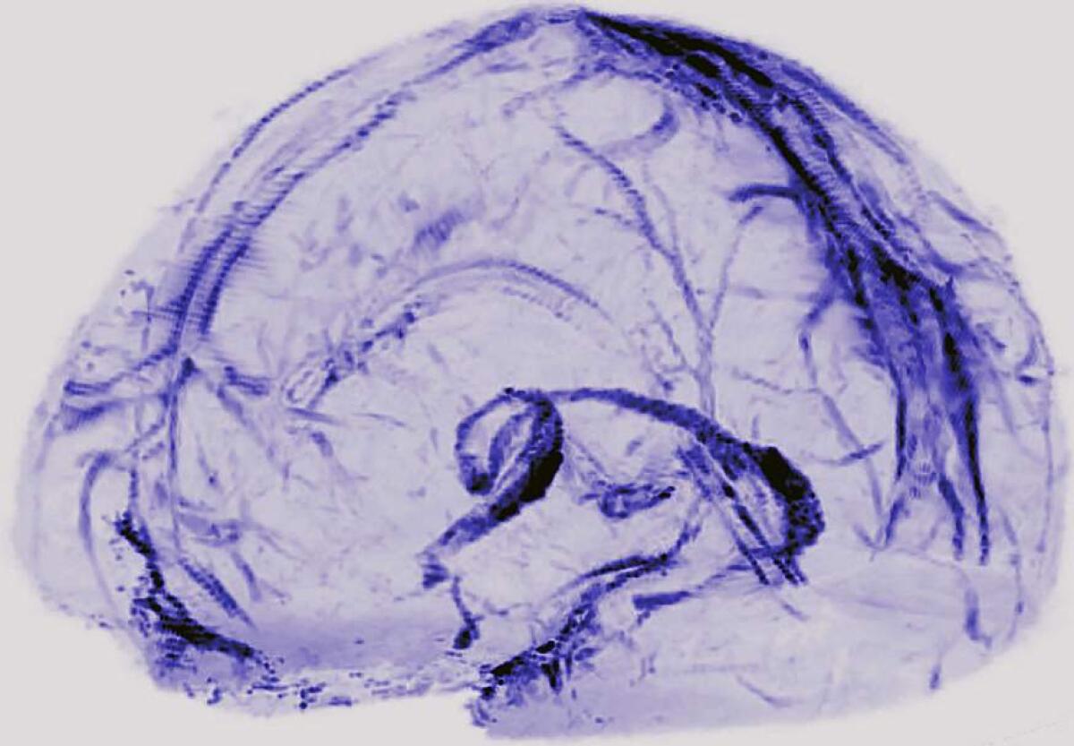 Scoperta rete linfatica nel cervello: drena i "rifiuti" - Sistema linfatico - cervello, credits: nih.gov