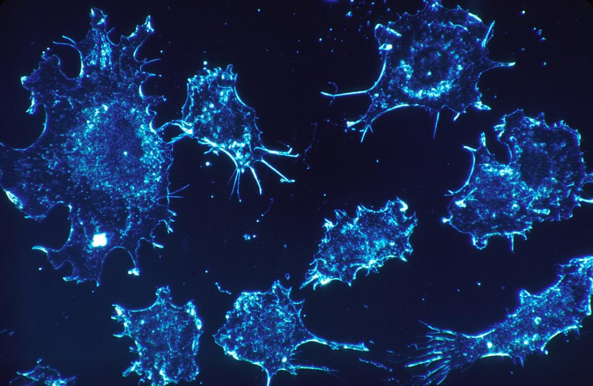 Combattere il cancro con il calore: ecco le nanoparticelle autoregolanti - Combattere il cancro con il calore: ecco le nanoparticelle autoregolanti