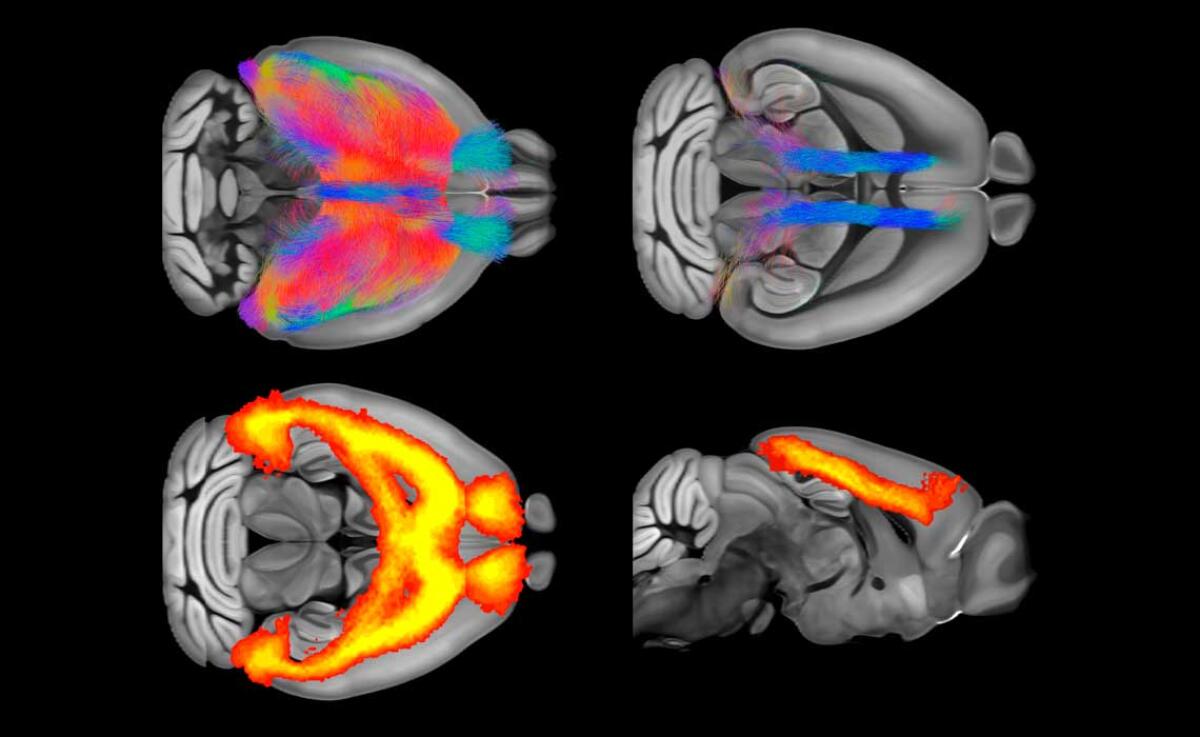 "Filmato" il cervello attivato dalla serotonina - Ph: cncs.iit.it