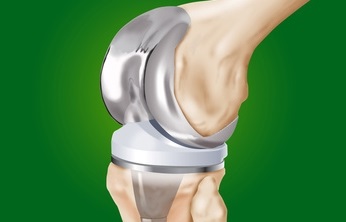 Protesi totale di ginocchiohttp://www.eurfisioterapia.it