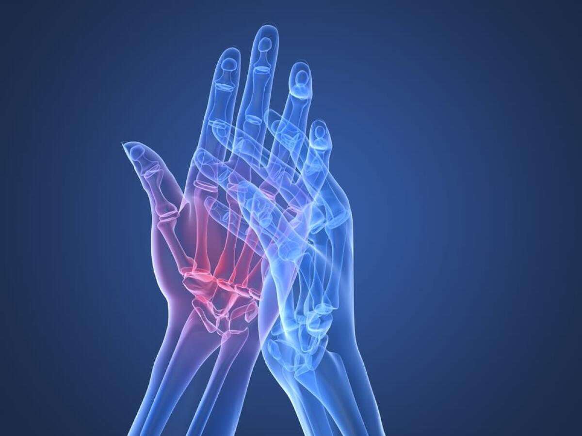Baricitinib, il farmaco 2.0 per l'artrite reumatoide - Artrite reumatoide, credits: energytherapy.biz
