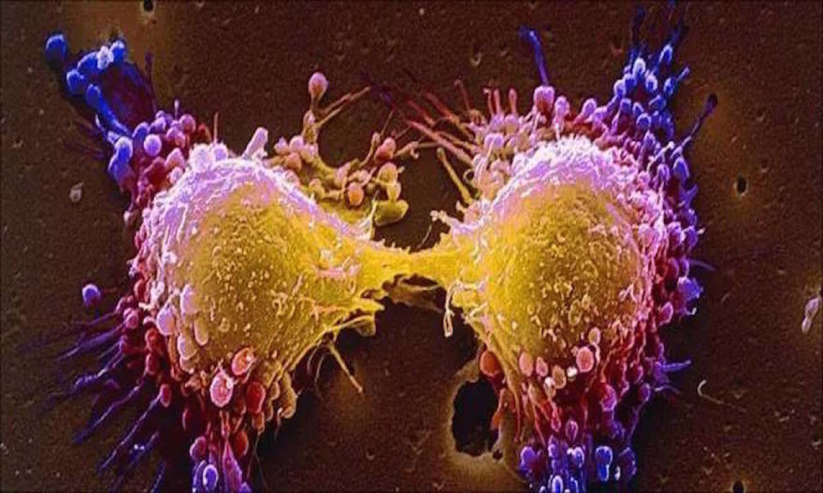 Spegnere i mitocondri per contrastare il cancro - 