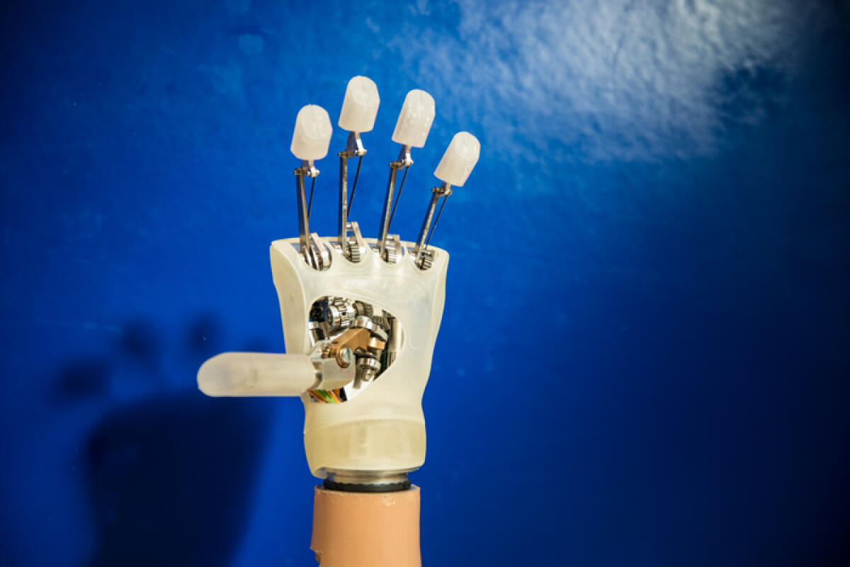 Impiantata per la prima volta in Italia la mano bionica sensibile - Impiantata per la prima volta in Italia la mano bionica sensibile
ANSA/Scuola Superiore Sant'Anna